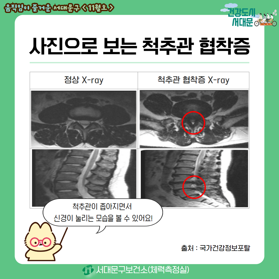 [움직임이 즐거운 서대문구 11월호] 건강 운동 정보